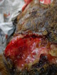 deep wound infected by maggot on his back