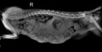 This is the X-ray taken, the left side shown the excrement and intestine moved to lung there