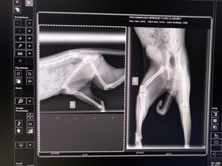 X-ray showing the fracture